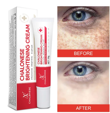 Buy 1 Get 1 Free - Chalonese Brightening Cream
